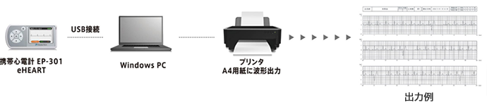 心電図判読支援ソフト