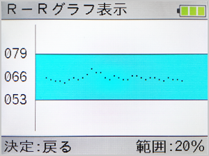 R-Rグラフの表示