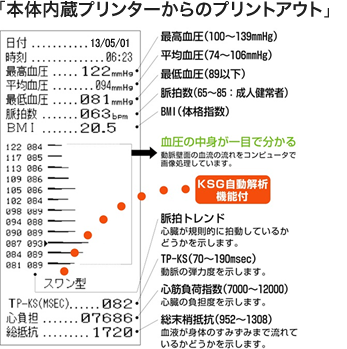 本体内蔵プリンターからのプリントアウト