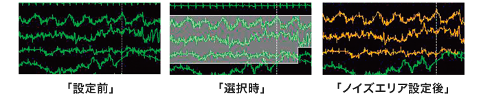 ホルター心電図解析システム