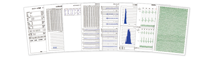 ホルター心電図解析システム