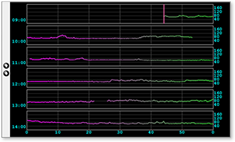 HRブラウザ（Heart Rate Browser）