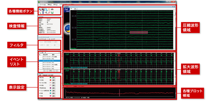 心電図波形データを自動解析し、手軽に解析・編集・レポート出力することができます。