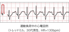 運動負荷検査用ワイヤレス12誘導心電・血圧計 Moerus(メロス)特徴