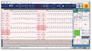 運動負荷検査用ワイヤレス12誘導心電・血圧計 Moerus(メロス)解析ソフトウェア