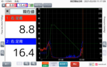 血流測定・SPP測定の開始