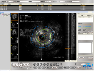 Nahri IVUS Viewer